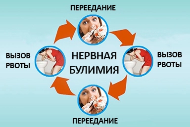 Лечение булимии в Нижнебаканской